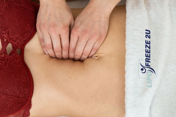diastasis recti treatment Basingstoke