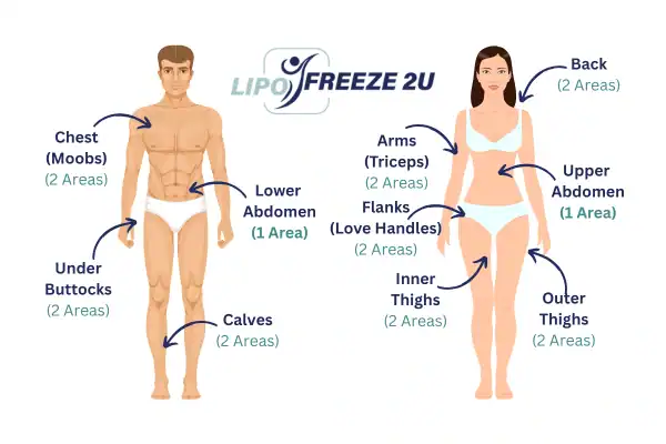 Areas you can have fat freezing treatment Basingstoke
