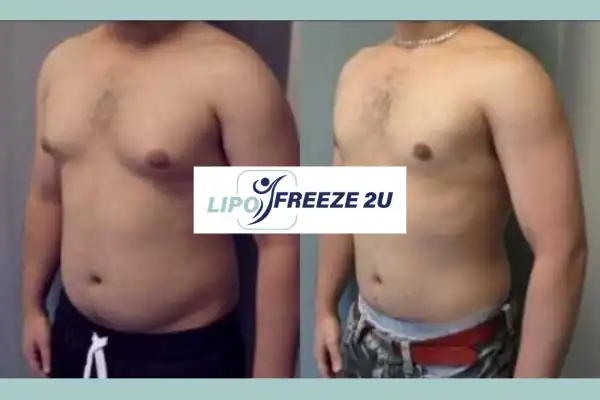 How Long Does It Take to See Results Basingstoke?