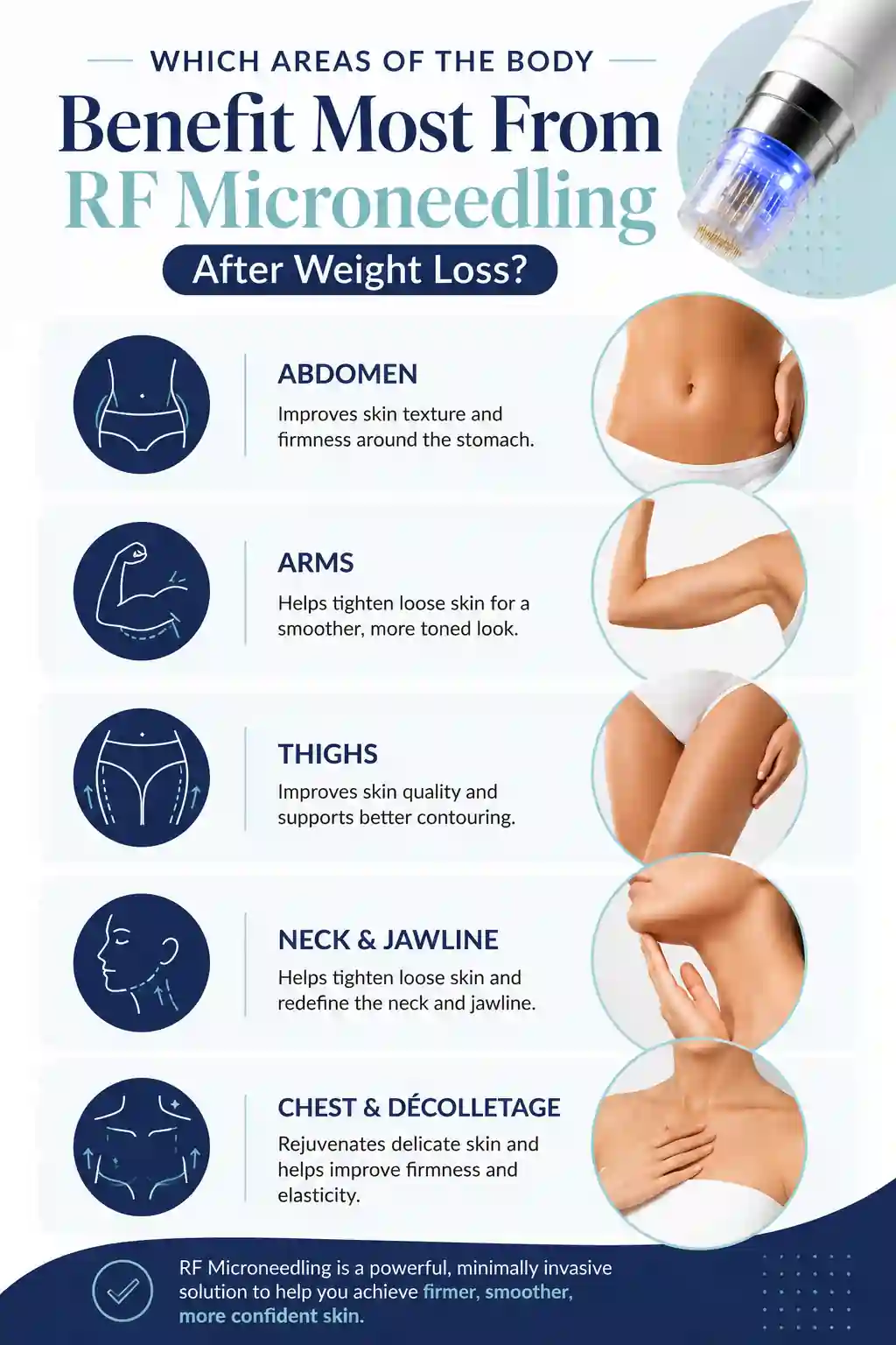 Which Areas of the Body Benefit Most From RF Microneedling After Weight Loss Basingstoke
